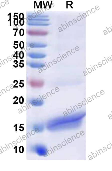 Human NCR2 Recombinant Protein (N-His)