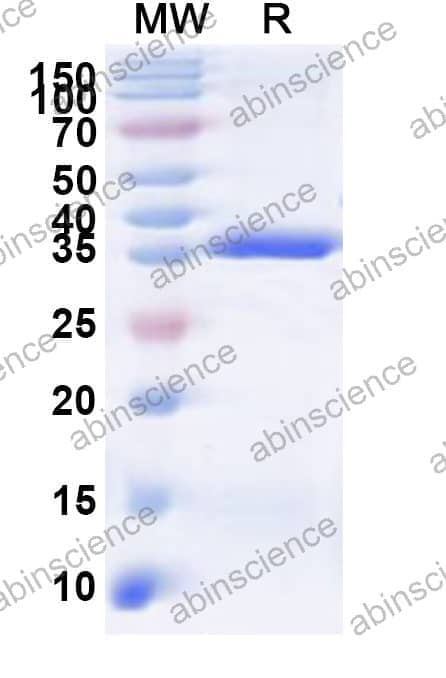 Human TRA2A Recombinant Protein (N-GST & C-His)