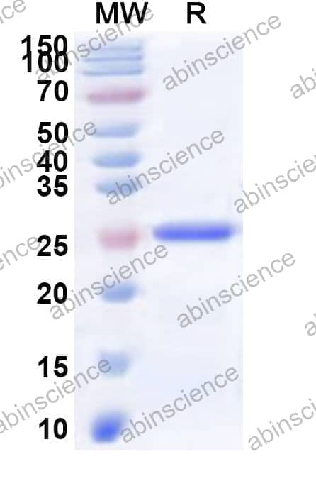 Human PACC1 Recombinant Protein (N-His)
