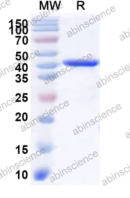 Human CDK18 Recombinant Protein (N-His)