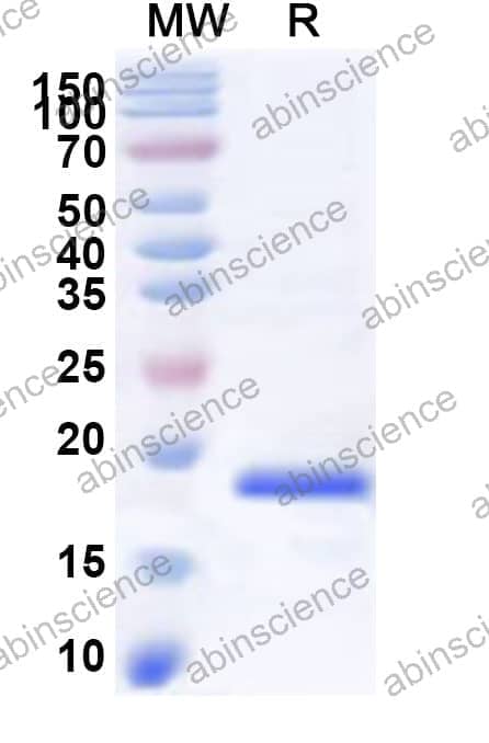 Human SLC34A1 Recombinant Protein (N-His)