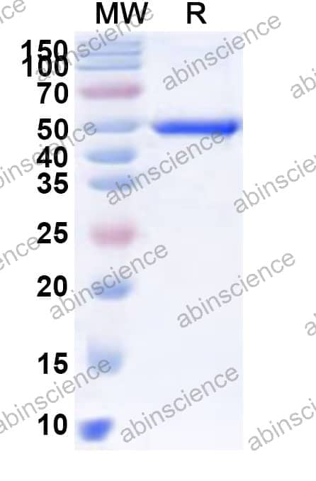 Human MGAT3 Recombinant Protein (N-His)