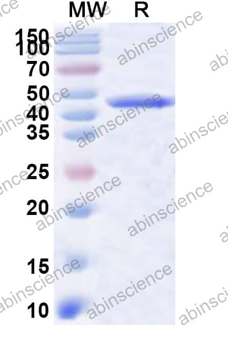 Human CPSF1 Recombinant Protein (N-His)
