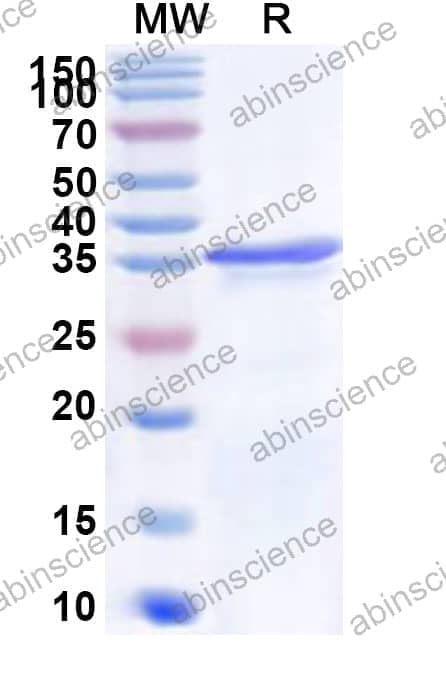 Human ST3GAL4 Recombinant Protein (N-His)
