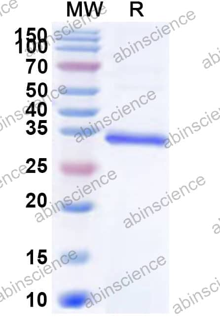 Human SMARCB1 Recombinant Protein (N-His)