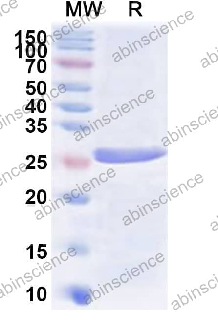 Human PKIA Recombinant Protein (N-His-KSI)