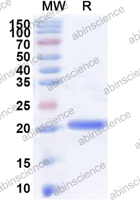 Human MTO1 Recombinant Protein (N-His)