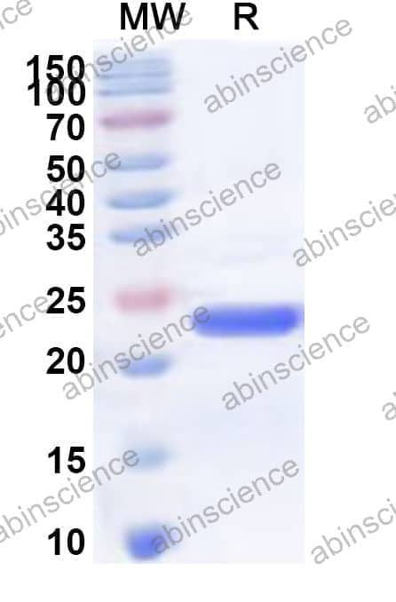 Human ATP5F1E Recombinant Protein (N-His-KSI)