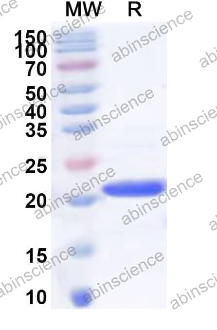 Human VBP1 Recombinant Protein (N-His)