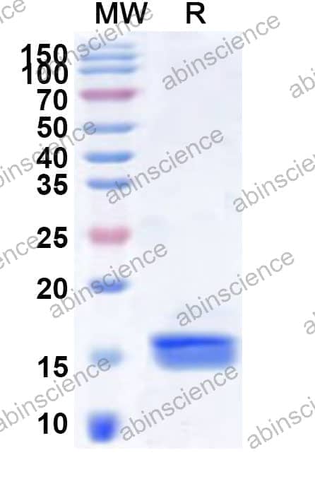Human GPD2 Recombinant Protein (N-His)