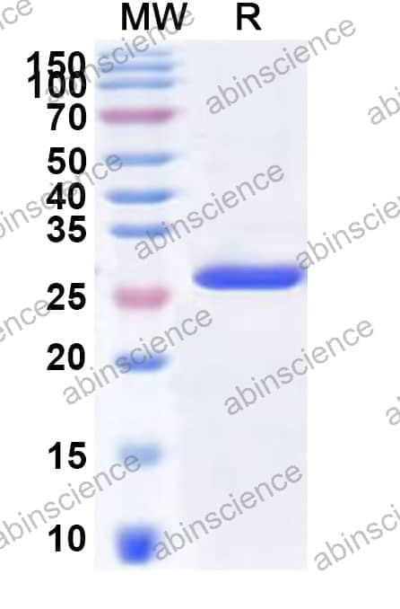 Human GHITM Recombinant Protein (N-His-KSI)