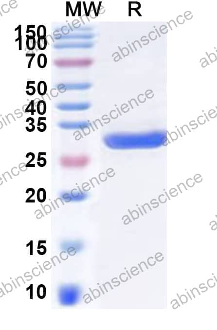 Human SMUG1 Recombinant Protein (N-His)