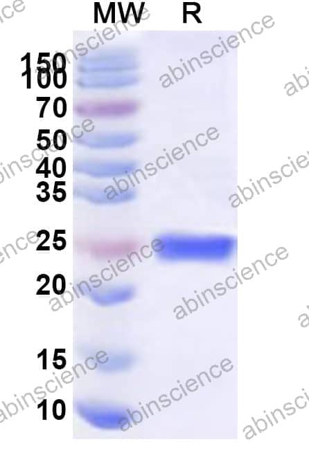 Human SF3B4 Recombinant Protein (N-His)