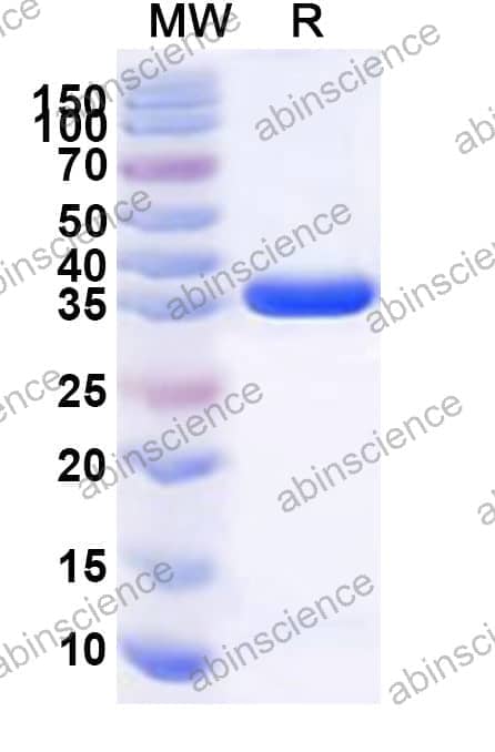 Human ALYREF Recombinant Protein (N-GST & C-His)