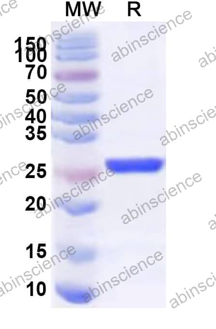 Human PGAM5 Recombinant Protein (N-His)