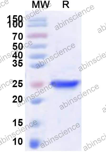 Human AVPR1B Recombinant Protein (N-His-KSI)