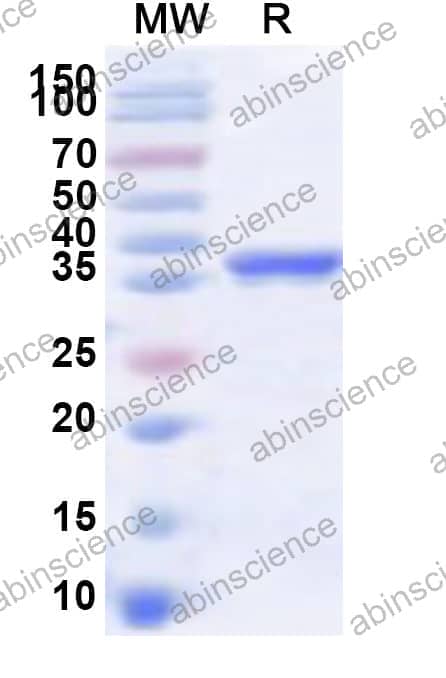 Human DAP3 Recombinant Protein (N-His)