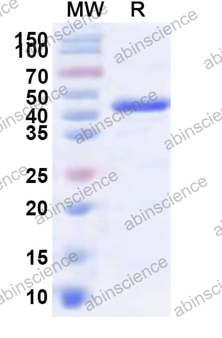 Human NOP2 Recombinant Protein (N-His)