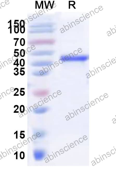 Human NRL Recombinant Protein (N-His-KSI)