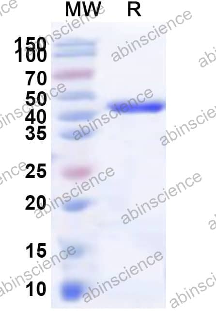 Human FMN1 Recombinant Protein (N-His)