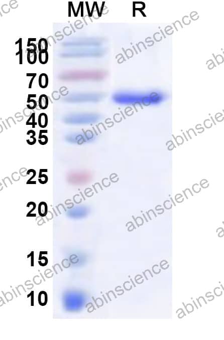 Human LBX1 Recombinant Protein (N-His-KSI)