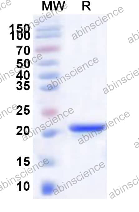 Human NAA20 Recombinant Protein (N-His)