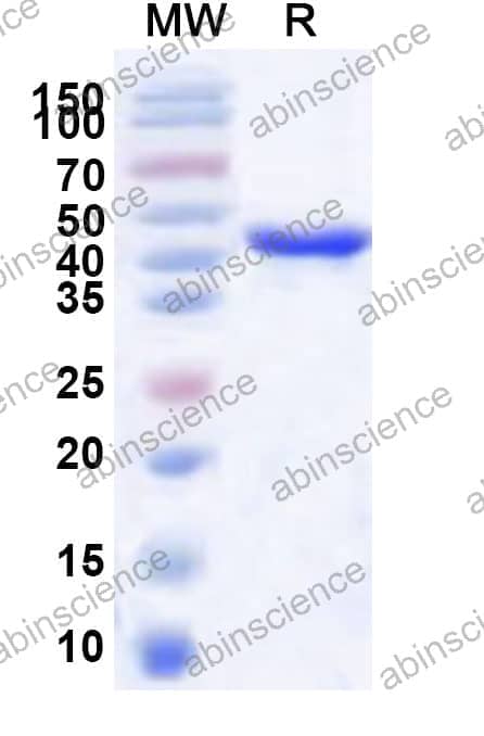 Human PSMC5 Recombinant Protein (N-His)