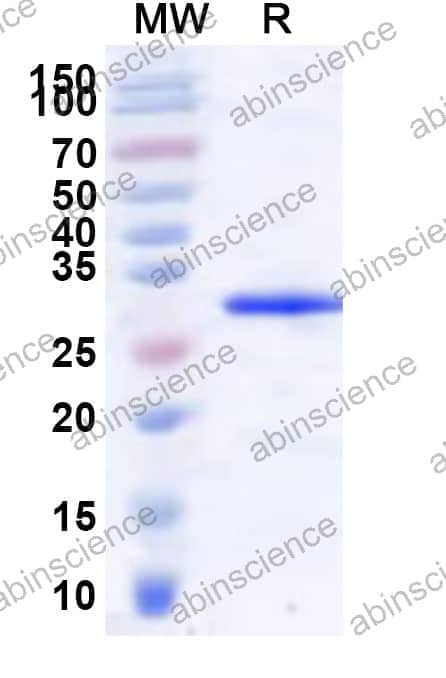 Human GRK3 Recombinant Protein (N-His)