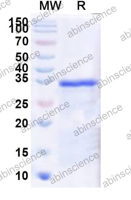 Human IRX4 Recombinant Protein (N-GST & C-His)