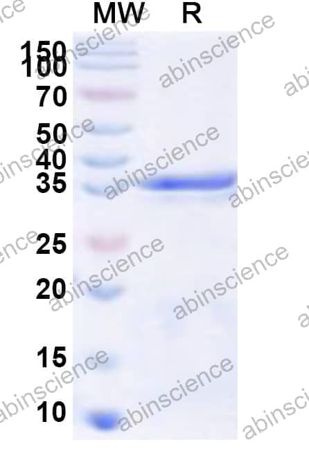 Human SNRPF Recombinant Protein (N-GST & C-His)