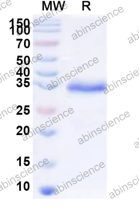 Human CREB5 Recombinant Protein (N-His-KSI)
