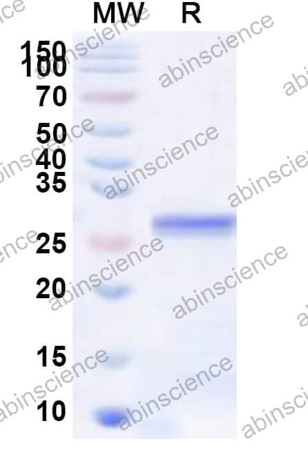 Human CHRND Recombinant Protein (N-His)