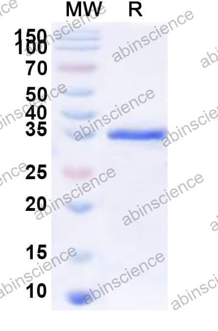 Human FOXE3 Recombinant Protein (N-GST & C-His)