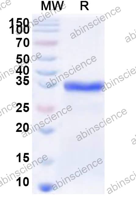 Human RIPPLY1 Recombinant Protein (N-His-KSI)