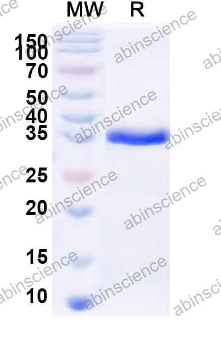 Human LAGE3 Recombinant Protein (N-GST & C-His)