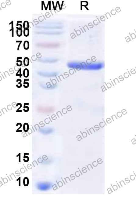 Human HES1 Recombinant Protein (N-His-KSI)