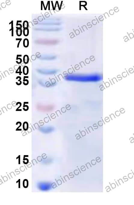 Human SSX1 Recombinant Protein (N-GST & C-His)
