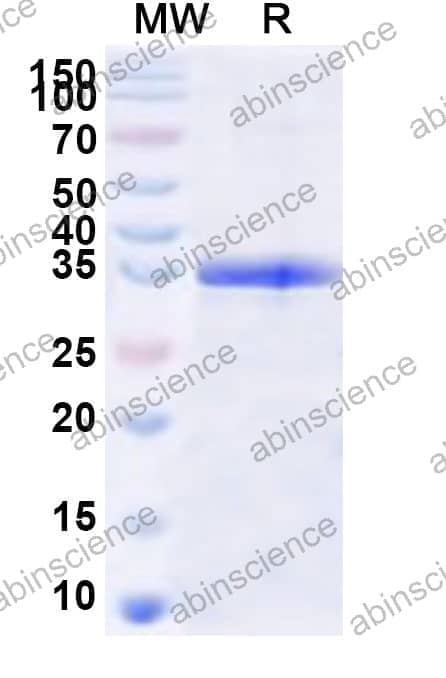 Human GNA13 Recombinant Protein (N-His)