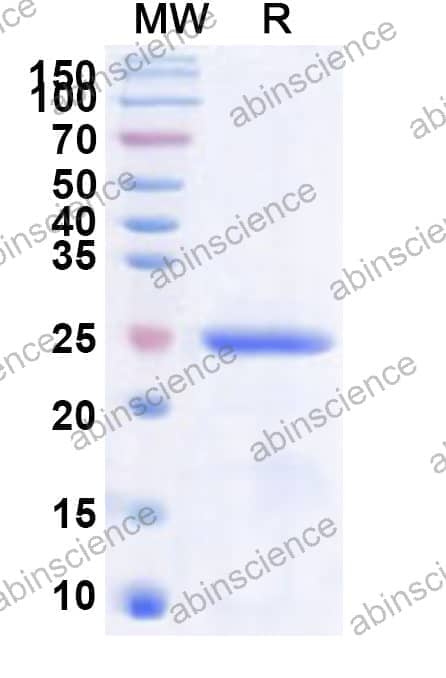 Human METTL21C Recombinant Protein (N-His)