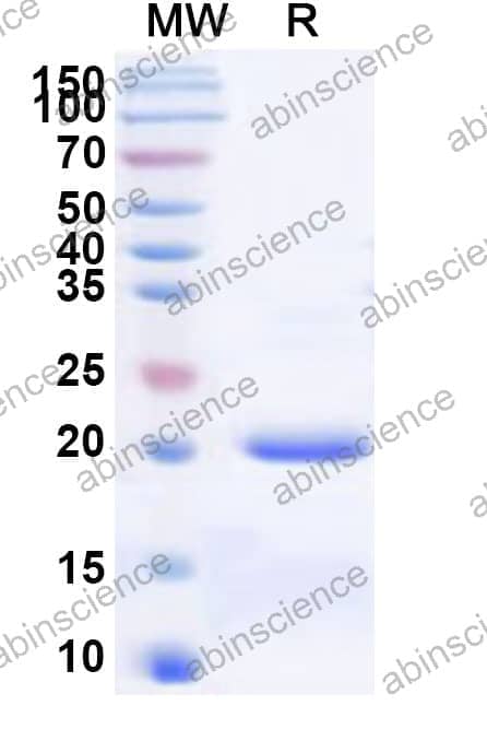 Human DCAF15 Recombinant Protein (N-His)