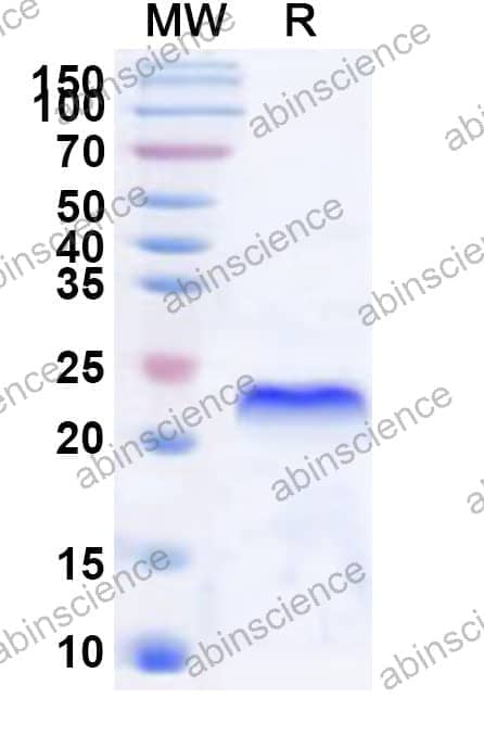 Human XAF1 Recombinant Protein (N-His)