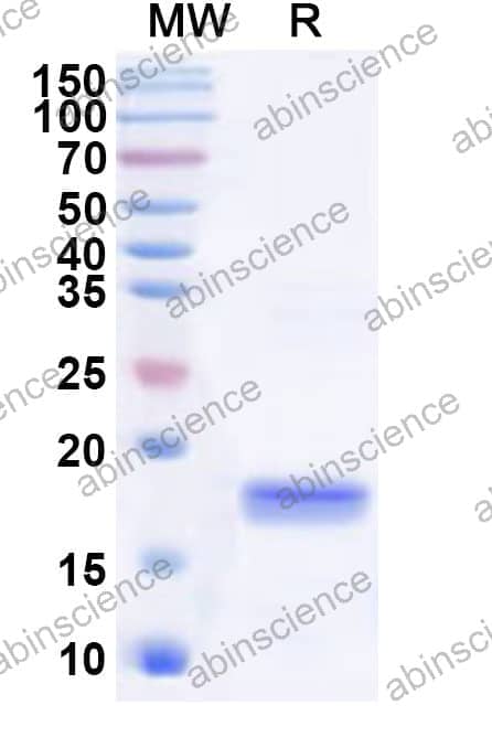 Human SLA Recombinant Protein (N-His)