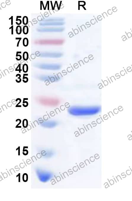Human CTF1 Recombinant Protein (N-His)