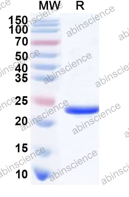 Human CBFB Recombinant Protein (N-His)