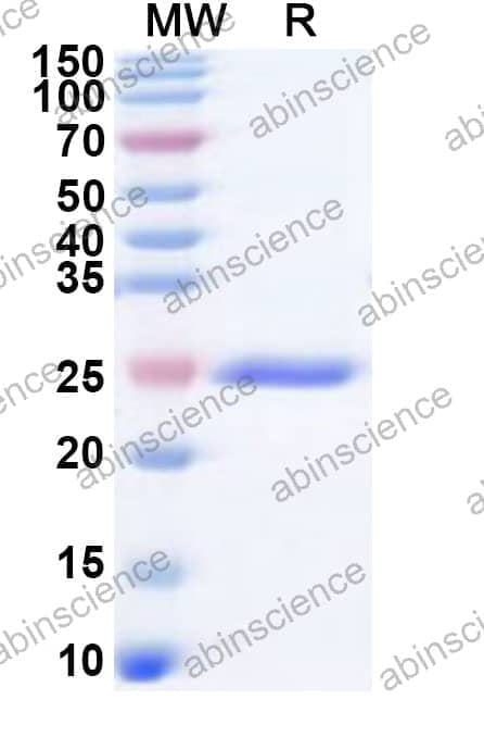 Human CNGA3 Recombinant Protein (N-His)