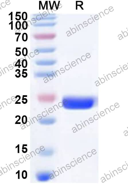 Human MEX3C Recombinant Protein (N-His)