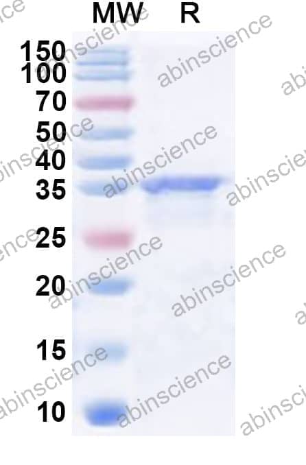 Human SHPRH Recombinant Protein (N-His)