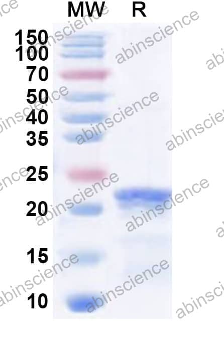 Human COL19A1 Recombinant Protein (N-His)