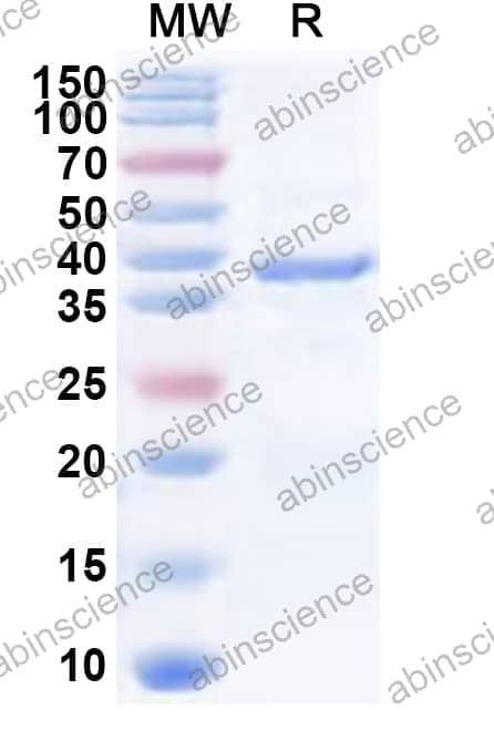 Human CDK10 Recombinant Protein (N-His)