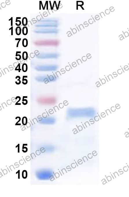 Human TRIP6 Recombinant Protein (N-His)